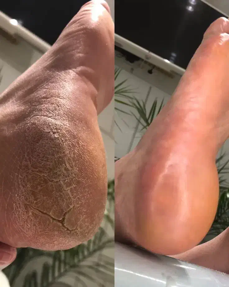 پارافین تراپی پدیکور کفسابی|خدمات آرایشگری و زیبایی|مشهد, چهارچشمه|دیوار