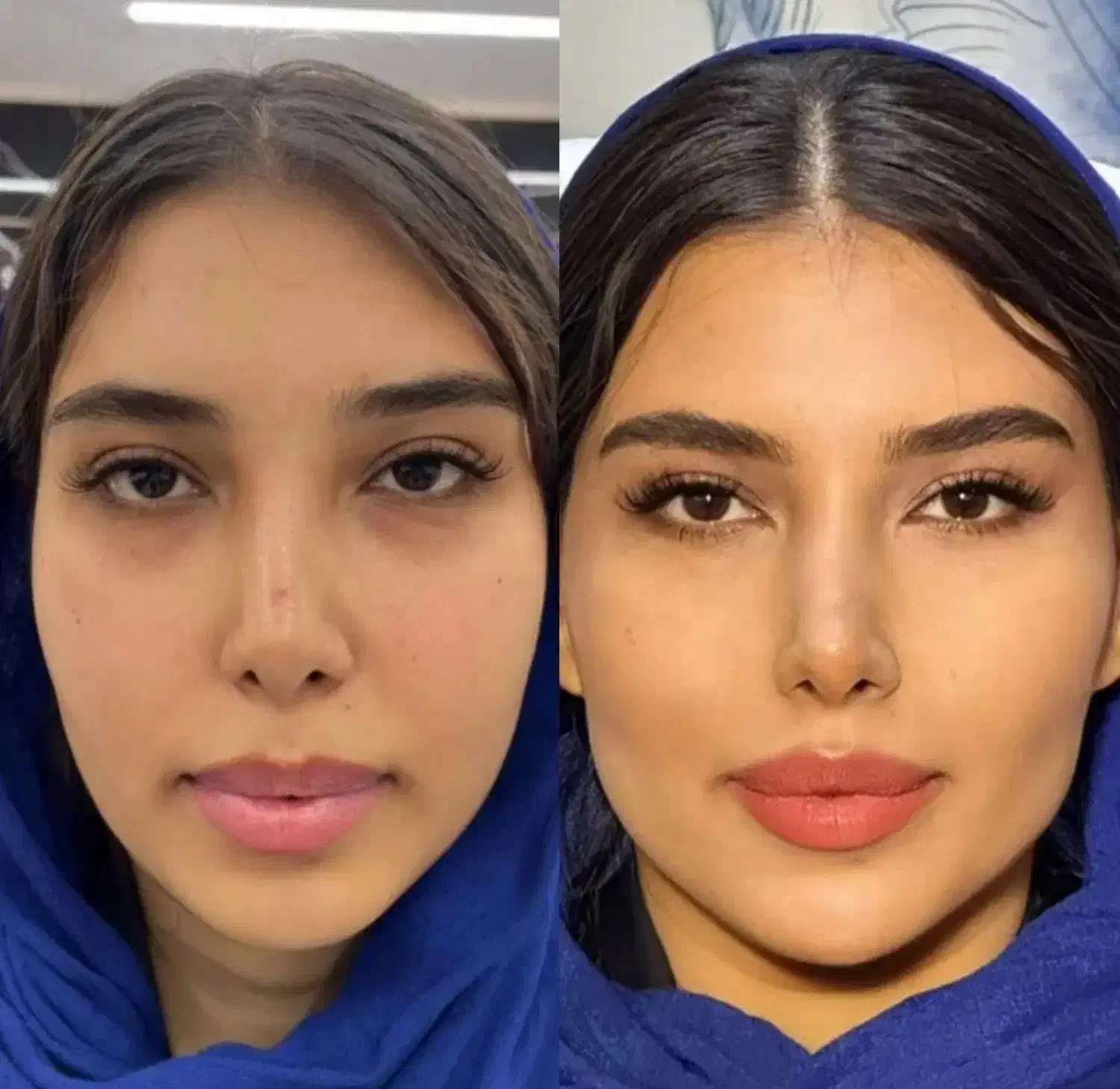 تخفیف به مناسبت روز مادر /ژل لب- کانتورینگ- بوتاکس|خدمات آرایشگری و زیبایی|مشهد, ایثار|دیوار