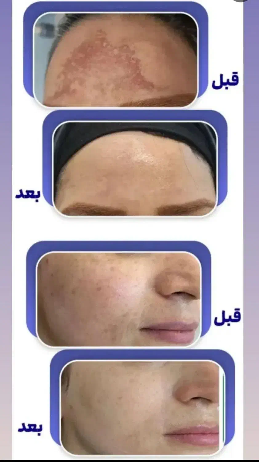 گل و|حراج|سرپل ذهاب, |دیوار