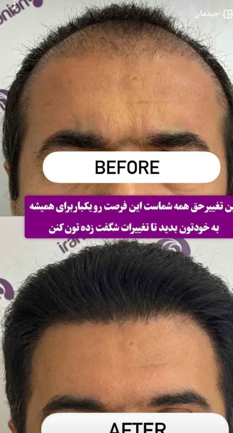 کلینیک تخصصی کاشت|خدمات آرایشگری و زیبایی|پیرانشهر, |دیوار
