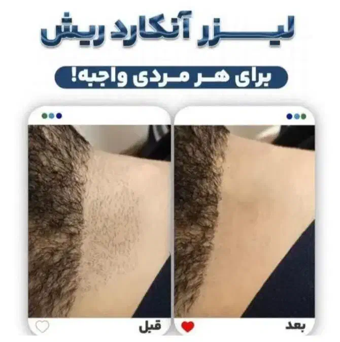 مرکز آموزش لیزر موج کندلا لیزر آقایان لیزر بانوان|خدمات آموزشی|اصفهان, شمس آباد|دیوار