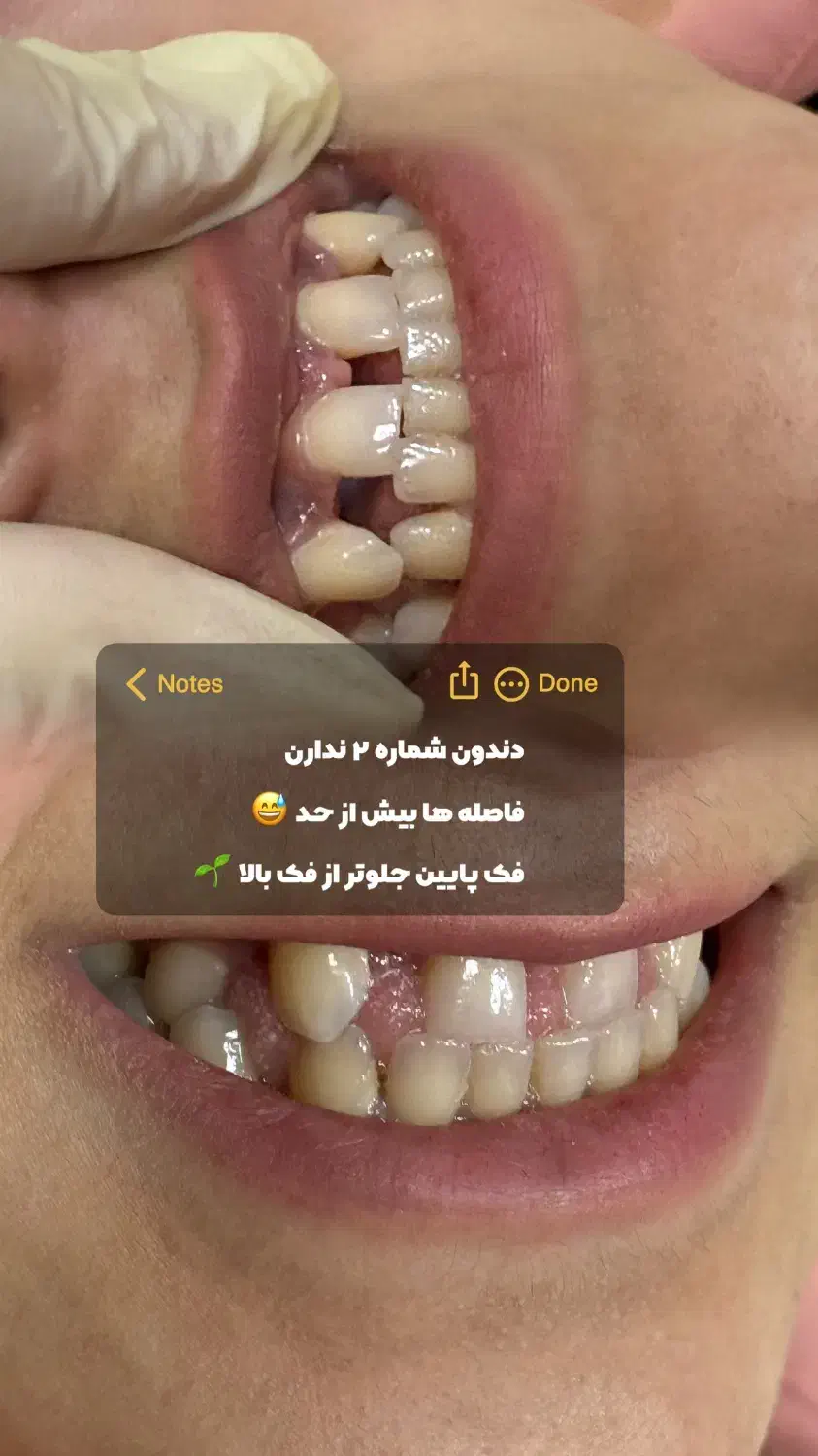 آموزش و کامپوزیت تکنیک جدید|خدمات آرایشگری و زیبایی|اهواز, زیتون کارمندی|دیوار