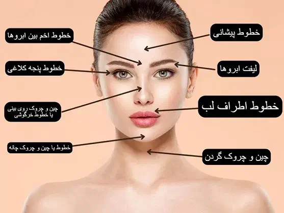 مدل بوتاکس(چشم گربه ایی)|خدمات آرایشگری و زیبایی|قم, بنیاد|دیوار