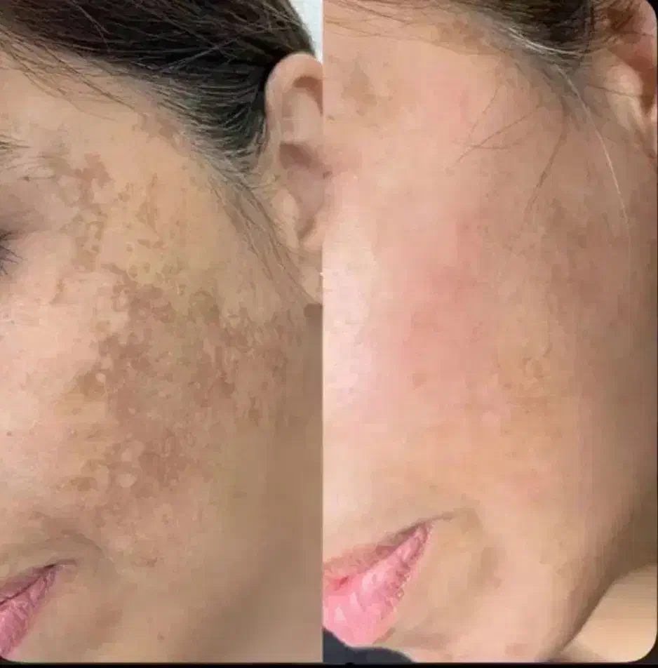 خدمات فیشال حرفه ای|خدمات آرایشگری و زیبایی|زابل, |دیوار