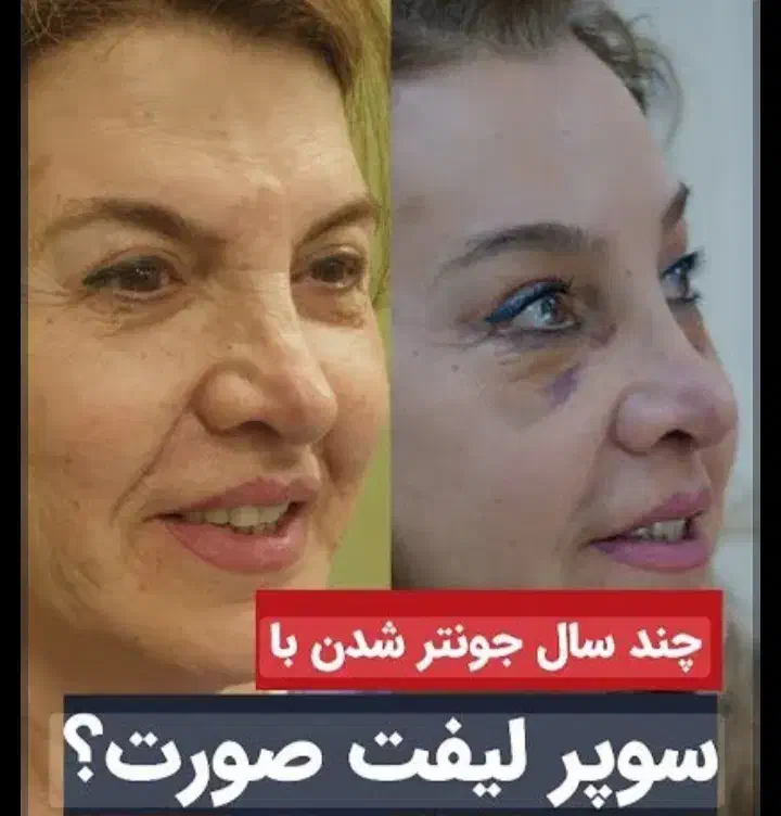 خدمات زیبایی و جوانسازی|خدمات آرایشگری و زیبایی|کرمانشاه, |دیوار