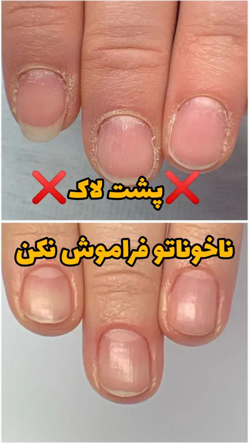 سرم تقویت ناخن اصل نمایندگی بردسیر|آرایشی، بهداشتی، درمانی|بردسیر, |دیوار