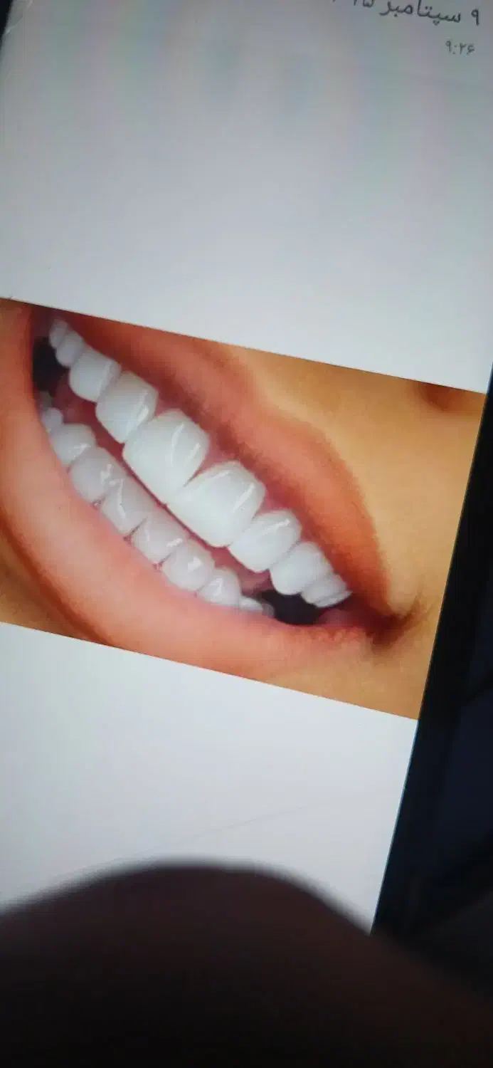 کار اموز خانم دندانسازی|استخدام درمانی، زیبایی، بهداشتی|اردبیل, |دیوار