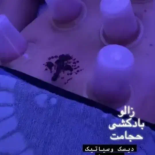 کلینیک درد درمان انواع درد های عضلانی|خدمات آرایشگری و زیبایی|اهواز, اهواز|دیوار