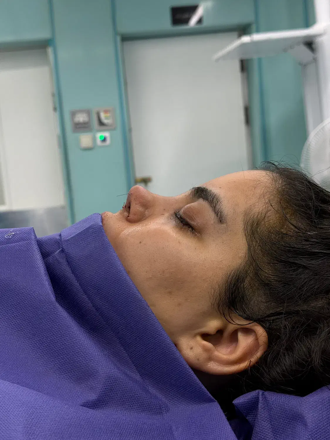 عمل بینی|خدمات آرایشگری و زیبایی|تهران, یوسفآباد|دیوار