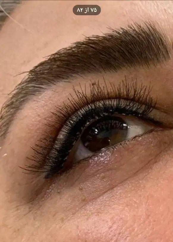 کاشت هیدن مژه|خدمات آرایشگری و زیبایی|رشت, چله خانه|دیوار