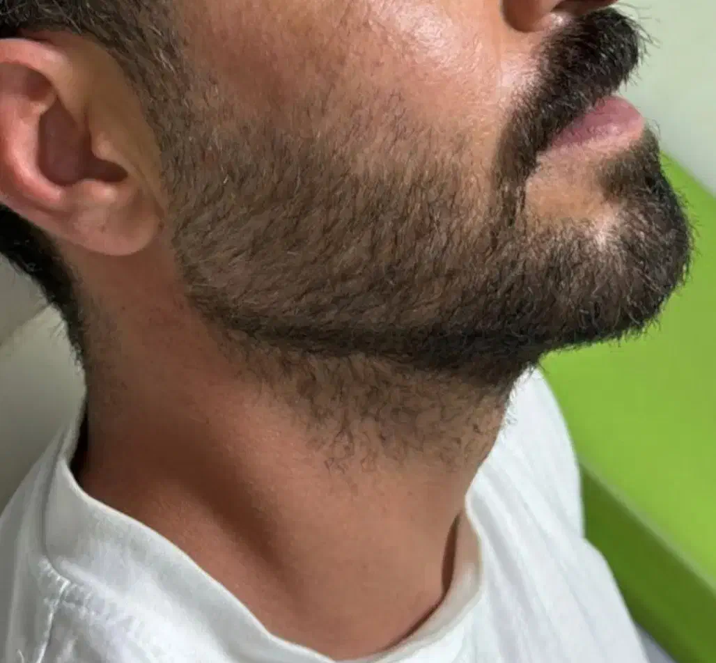 تزریق ژل و بوتاکس|خدمات آرایشگری و زیبایی|اصفهان, گلزار|دیوار