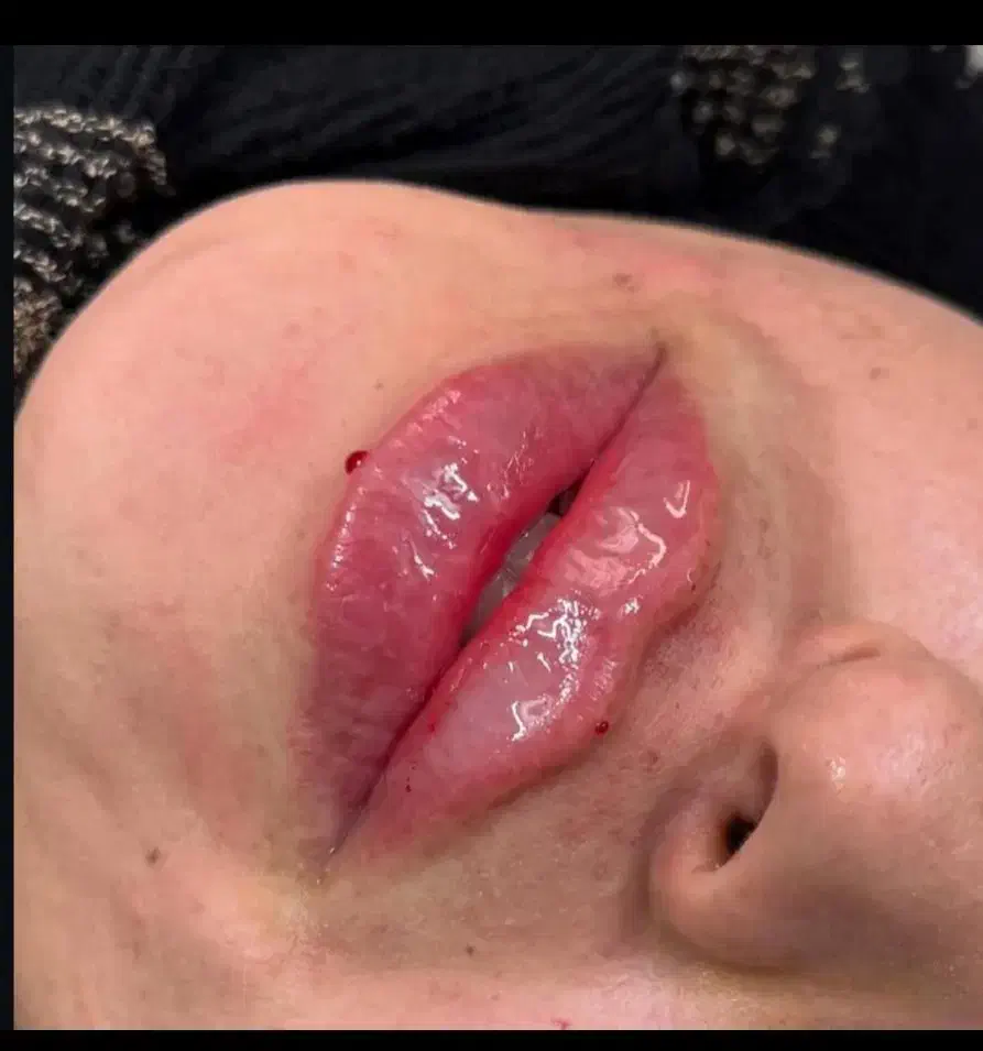 تخفیف ژل ،بوتاکس ،جوانساز،فیلر وفیشیال|خدمات آرایشگری و زیبایی|کرج, مهرویلا جنوبی|دیوار