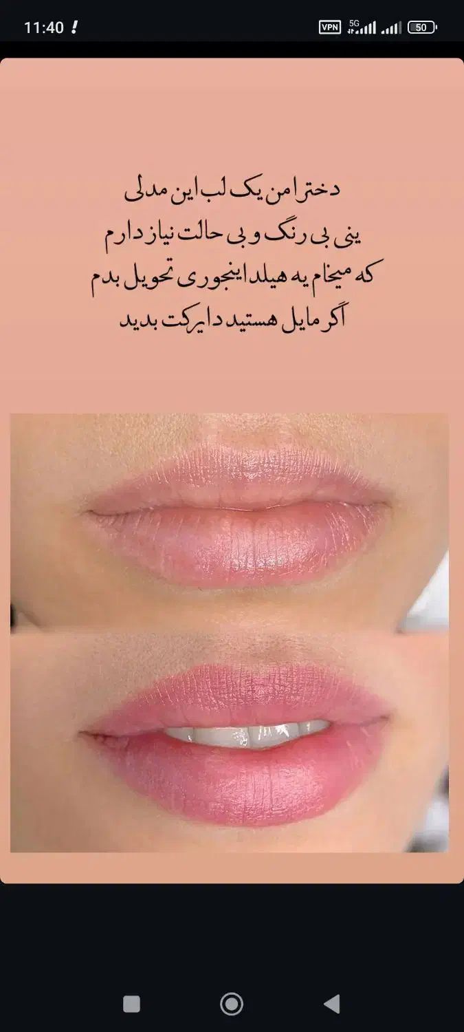 شیدینگ لب خانم و آقا (رفع تیرگی) و درمان خشکی لب|خدمات آرایشگری و زیبایی|اصفهان, فیض|دیوار
