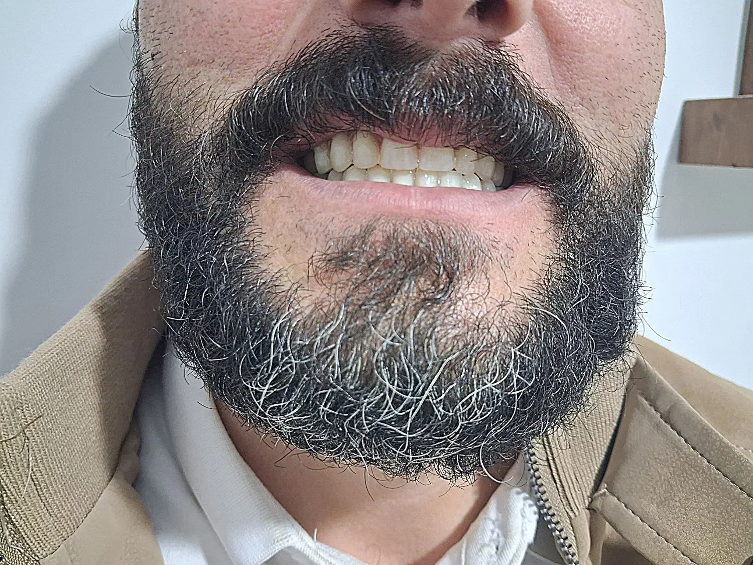 دندانسازی متحرک(شرایط خوب)|خدمات آرایشگری و زیبایی|قیدار, |دیوار