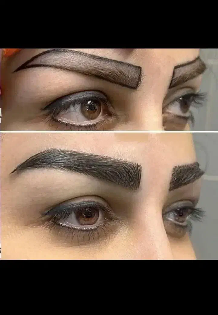 اقساطی کاشت مو تضمینی/کاشت ابرو کاشت|خدمات آرایشگری و زیبایی|تهران, چیذر|دیوار