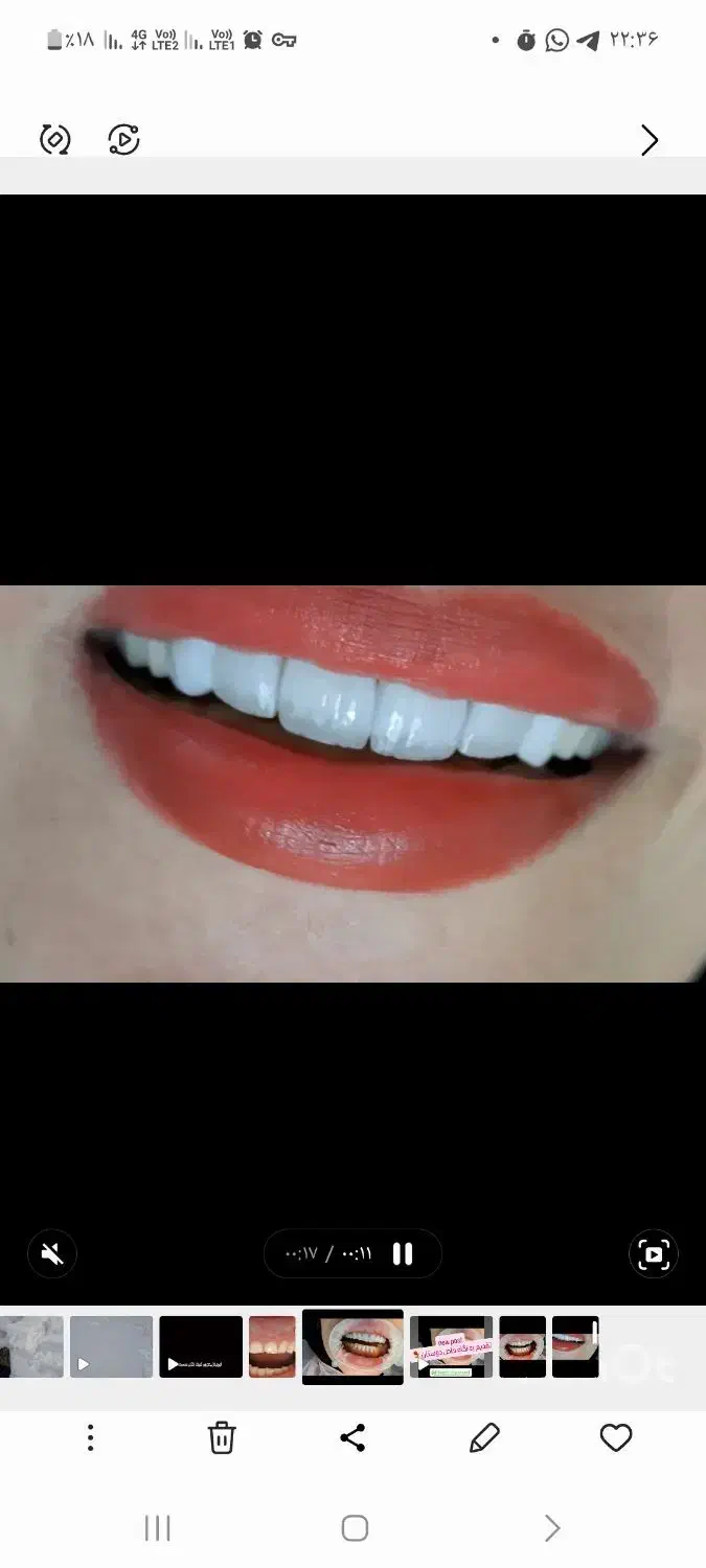 منشی دندانپزشکی|استخدام درمانی، زیبایی، بهداشتی|خرمآباد, |دیوار