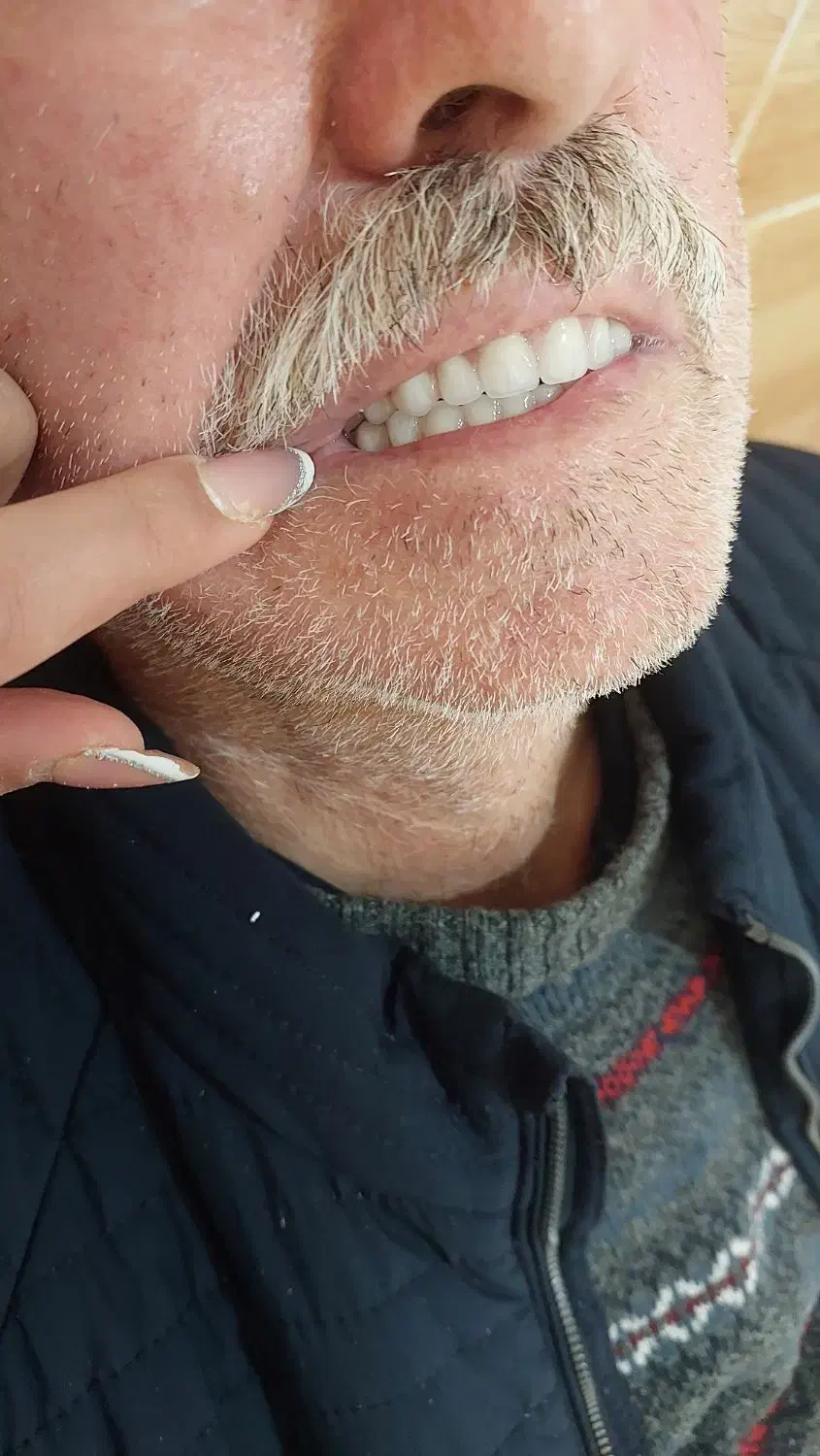 ساخت دندان مصنوعی|پزشکی|سنندج, |دیوار