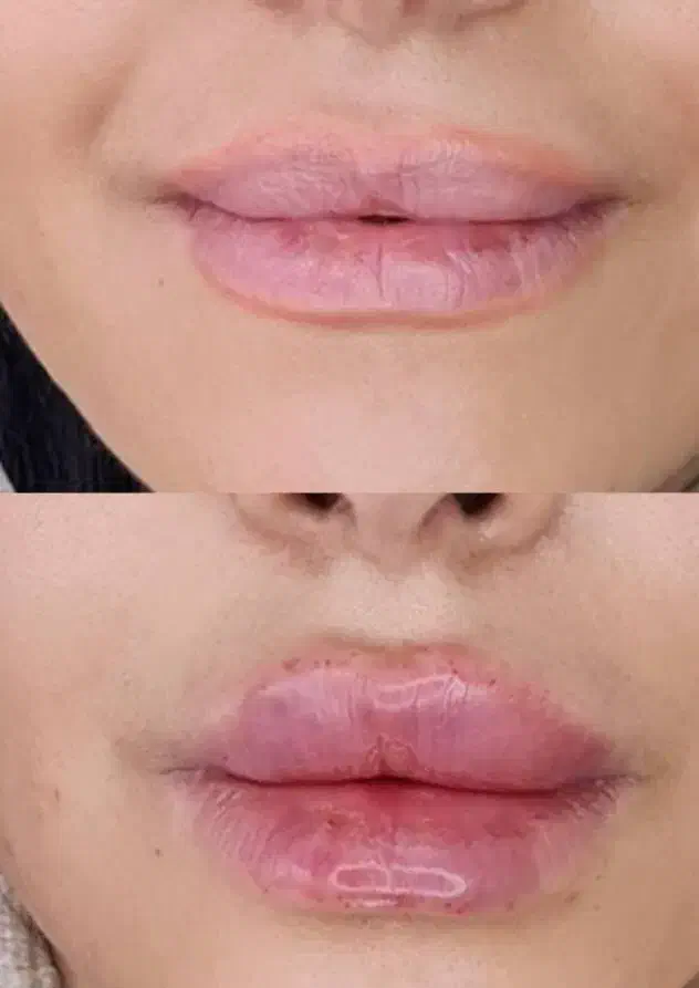 ژل لب گونه چونه زاویه خدمات پرسینگ|خدمات آرایشگری و زیبایی|صدرا-فارس, فاز ۱|دیوار