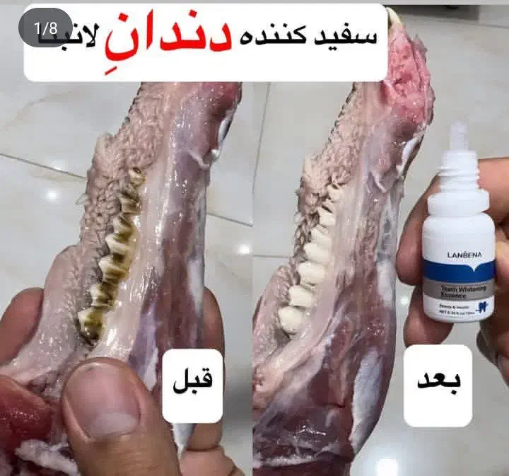 تمیزی دندان فوری تضمینی|آرایشی، بهداشتی، درمانی|قم, مجیدیه|دیوار