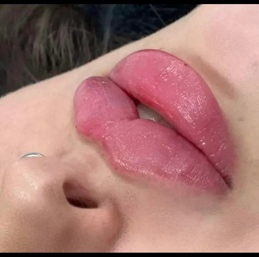 تخفیف ژل ،بوتاکس ،جوانساز،فیلر وفیشیال|خدمات آرایشگری و زیبایی|کرج, مهرویلا جنوبی|دیوار