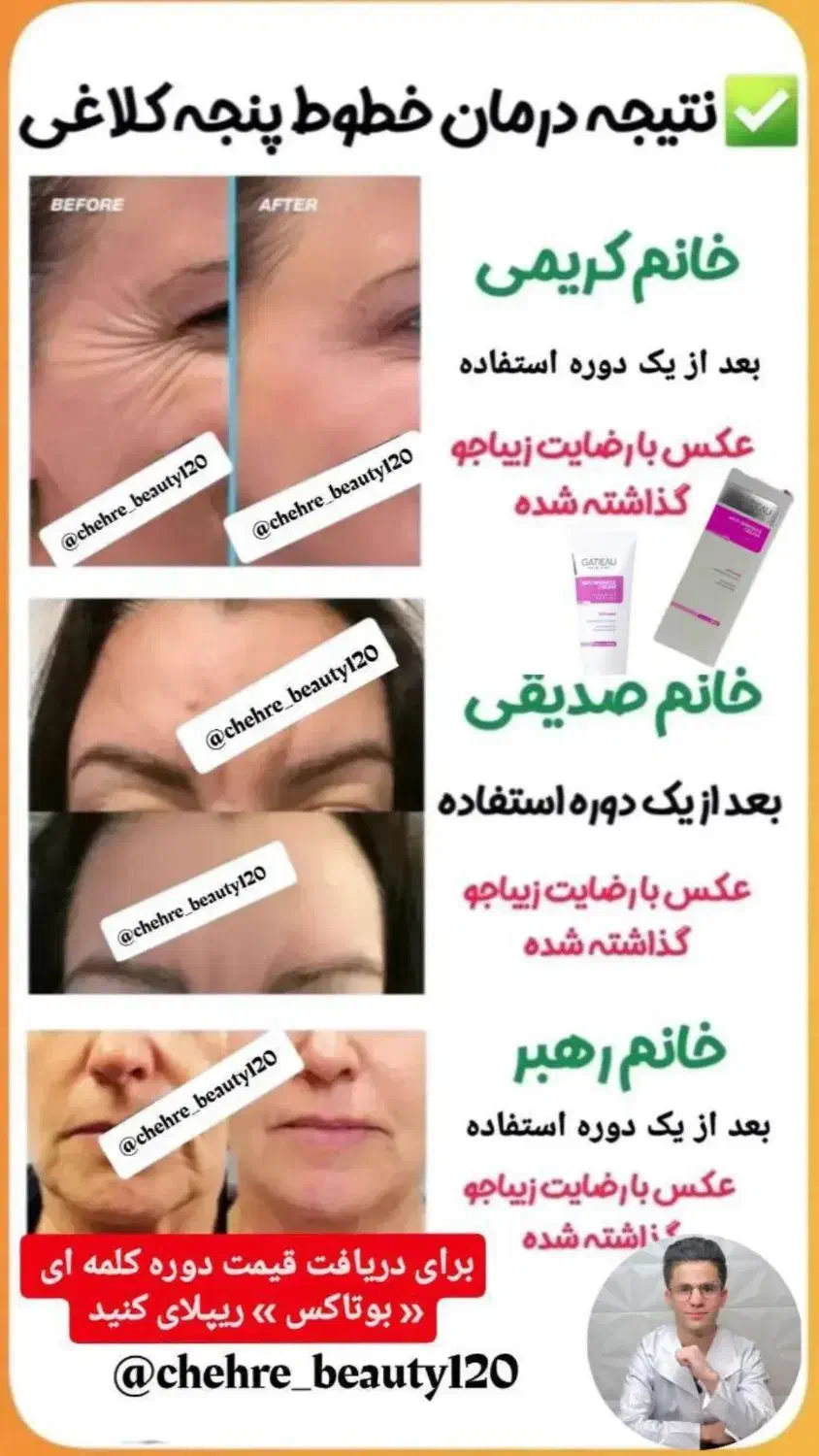 کرم بوتاکس صورت|آرایشی، بهداشتی، درمانی|اهواز, کیان اباد|دیوار