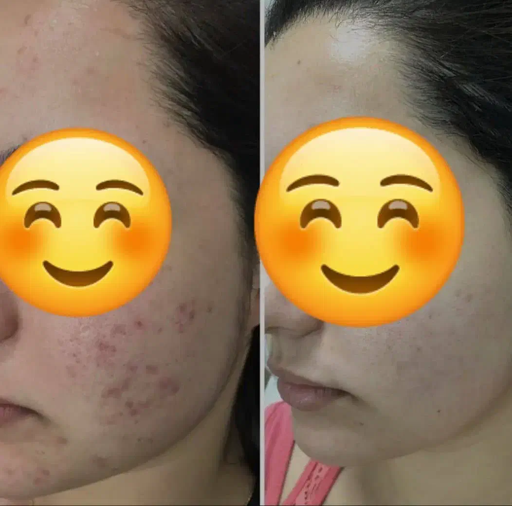 کرم سفیده کننده صددرصد تضمینی|آرایشی، بهداشتی، درمانی|رفسنجان, |دیوار