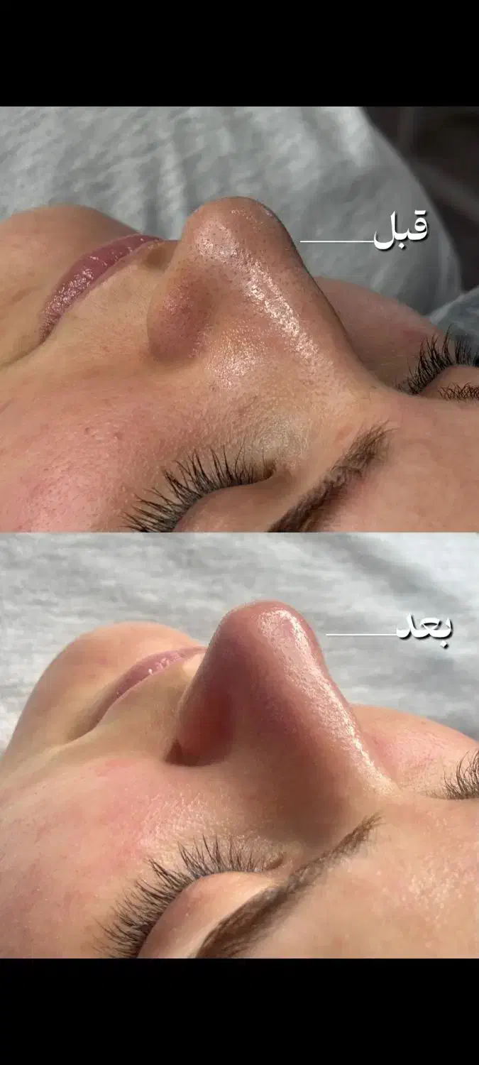 تخفیف ویژه فشیال، میکاپ و لیفت مژه|خدمات آرایشگری و زیبایی|سبزوار, پاسداران|دیوار