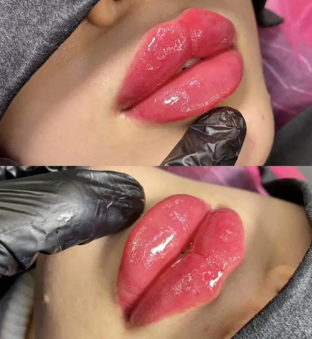 آموزش پزشک بوتاکس نخ مزو ژل لیفت prp لیزرآنزیم مطب|خدمات آموزشی|کرج, گوهردشت|دیوار