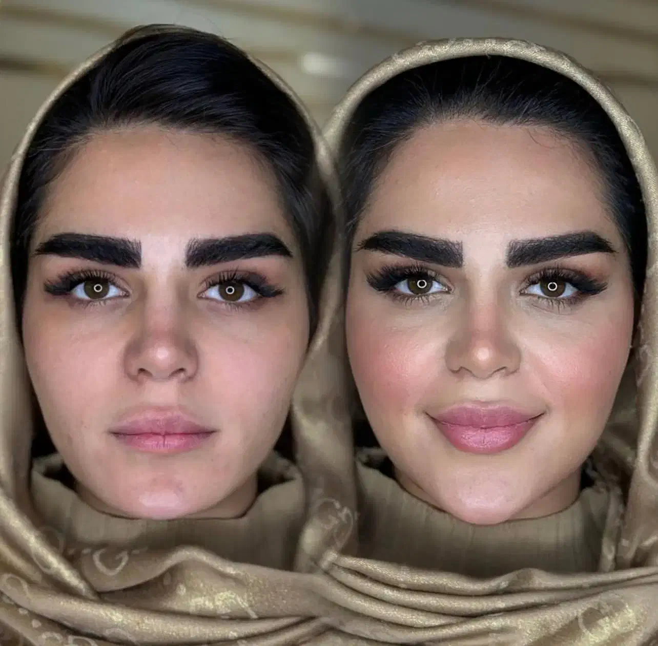جشنواره  فیلر بیکینی مدلینگ ،بوتاکس ،شقیقه زیر چشم|خدمات آرایشگری و زیبایی|تهران, اختیاریه|دیوار