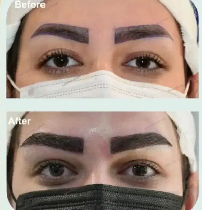 تخفیف کلینیک ژل بوتاکس نخ|خدمات آرایشگری و زیبایی|یاسوج, |دیوار