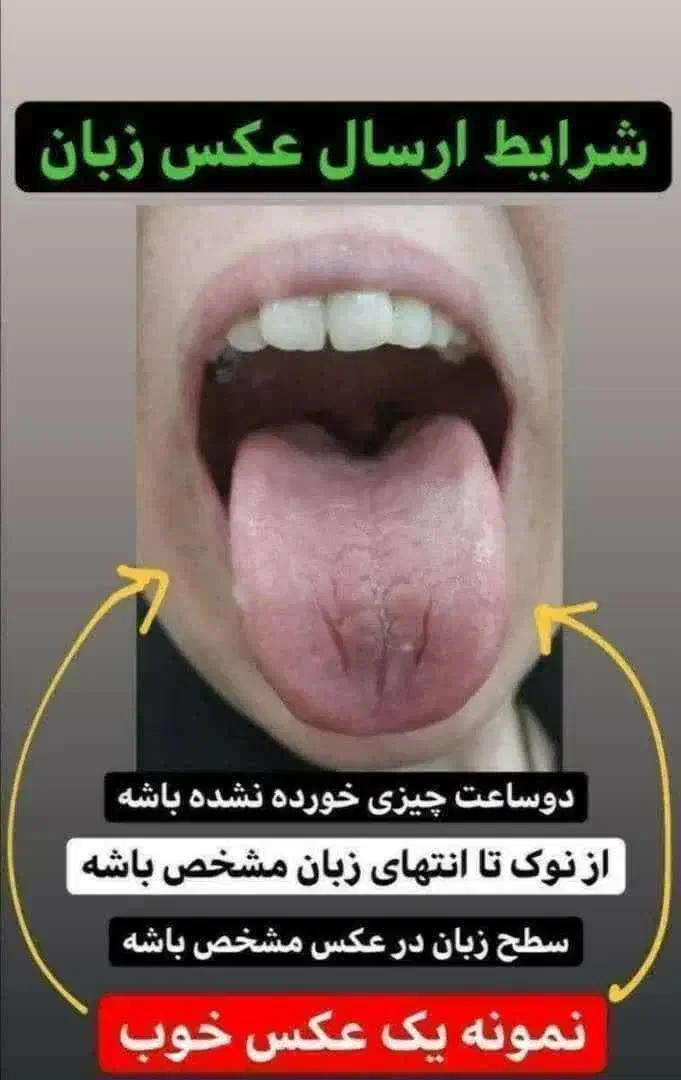 مشاورطب سنتی وزبان شناسی|فعالیت داوطلبانه|رباط‌کریم, رباط‌کریم|دیوار