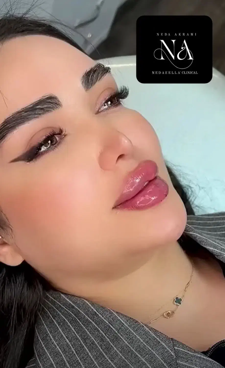 ژل لب و فول فیس ۳۷۰هزار تومان توسط پزشک کلینیک|خدمات آرایشگری و زیبایی|کرج, گوهردشت|دیوار