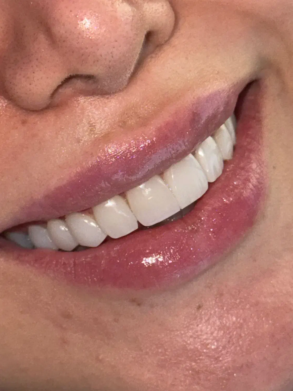 دکتر دنداپزشک زیبایی|استخدام درمانی، زیبایی، بهداشتی|تهران, دزاشیب|دیوار