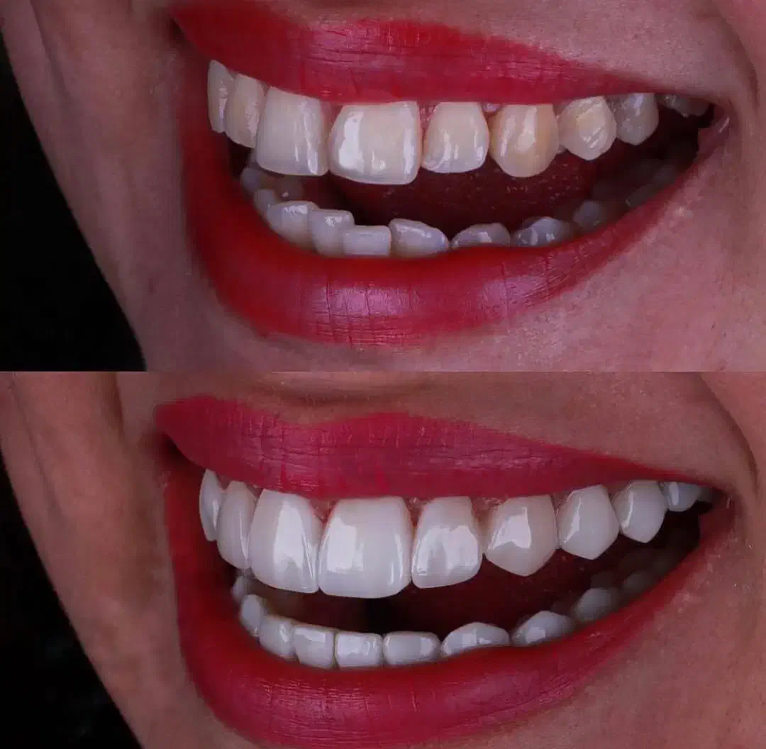 تخفیف‌های ویژه دندانپزشکی عکس تمام فک رایگان|خدمات آرایشگری و زیبایی|فردیس, شهرک هفده شهریور|دیوار