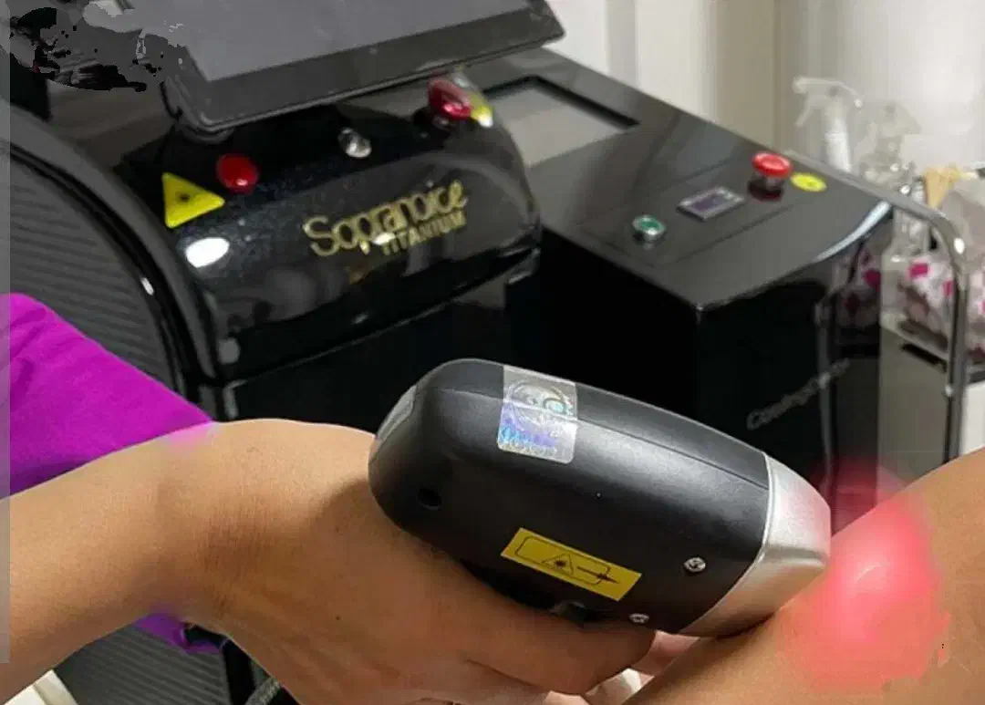 لیزرمو های زائد در offfفقط ۳۵۰تومان|خدمات آرایشگری و زیبایی|مشهد, شهید معقول|دیوار