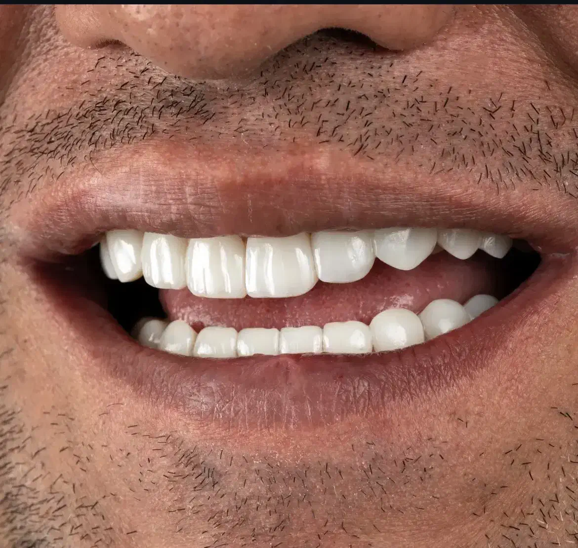 جشنواره پاییژه دندانپزشکی|خدمات آرایشگری و زیبایی|قم, چهار امامزاده|دیوار