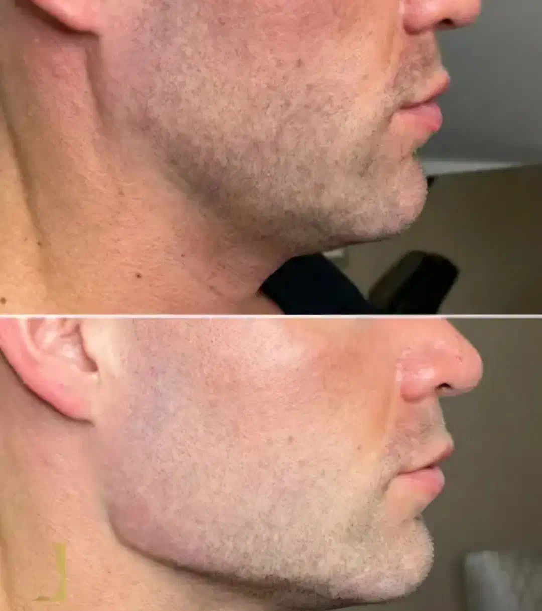 جشنواره پاییزه تزریق ژل بوتاکس مزوژل درکلینیک پزشک|خدمات آرایشگری و زیبایی|اصفهان, وحید|دیوار