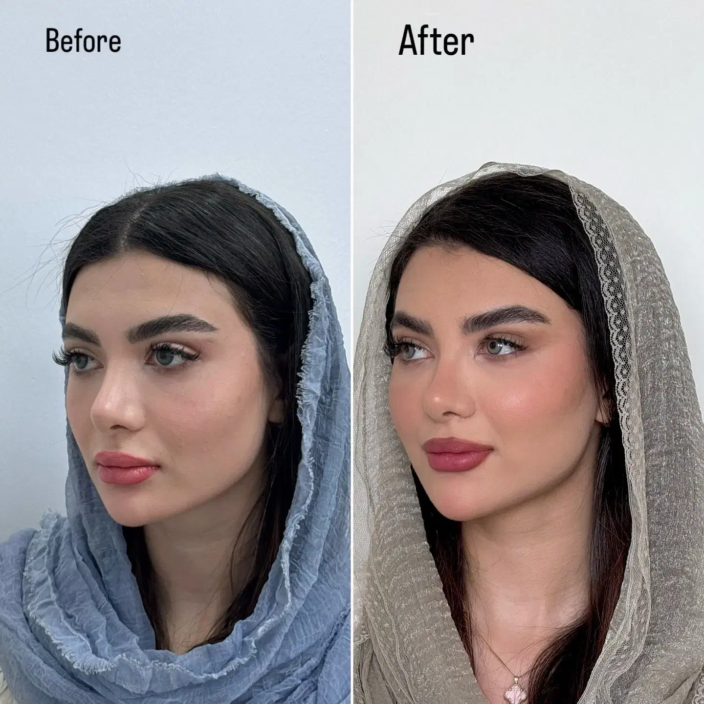 مدل تزریق فیلر،زاویه سازی ،لیفت با نخ، فیلر باسن|خدمات آرایشگری و زیبایی|تهران, قیطریه|دیوار