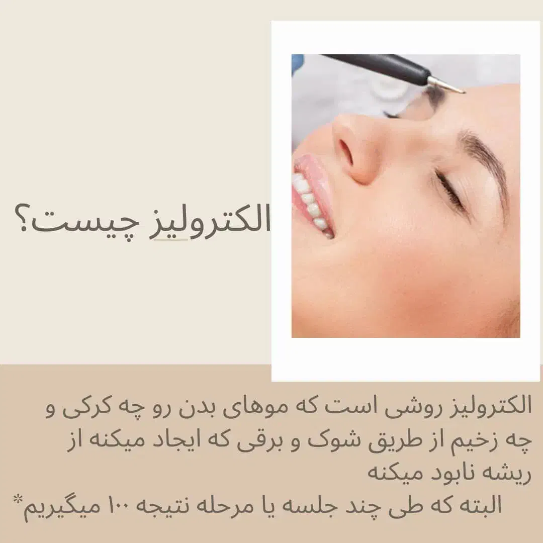 الکترو لیز|خدمات آرایشگری و زیبایی|دوگنبدان, |دیوار