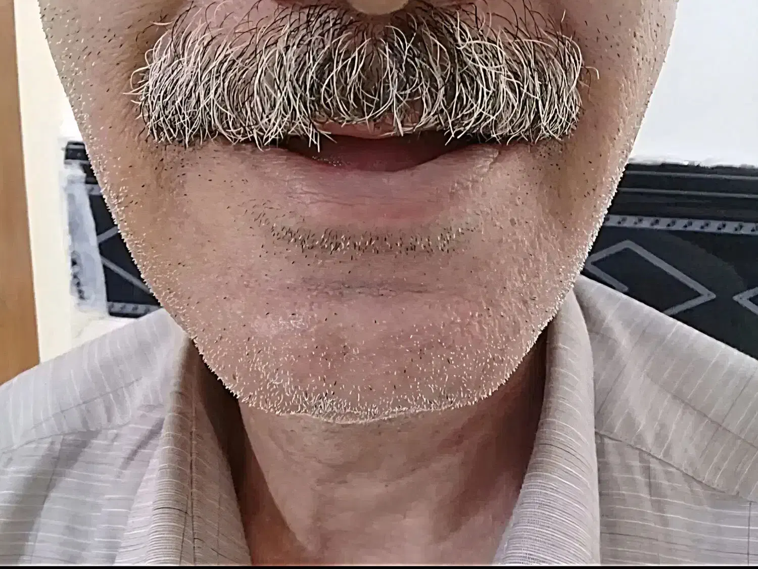 دندان کامل(شرایطی ویژه)|خدمات آرایشگری و زیبایی|سلطانیه, |دیوار