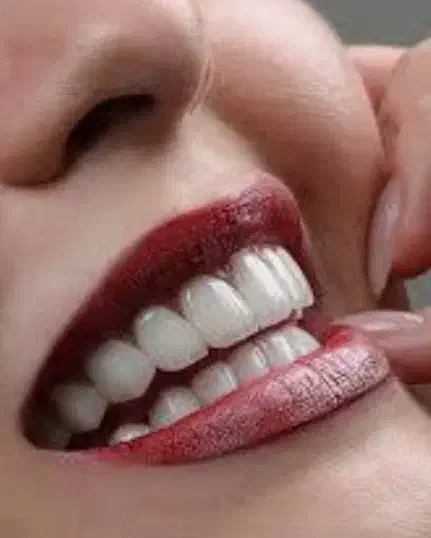 گل با گلدان|گل و گیاه طبیعی|سارال, |دیوار