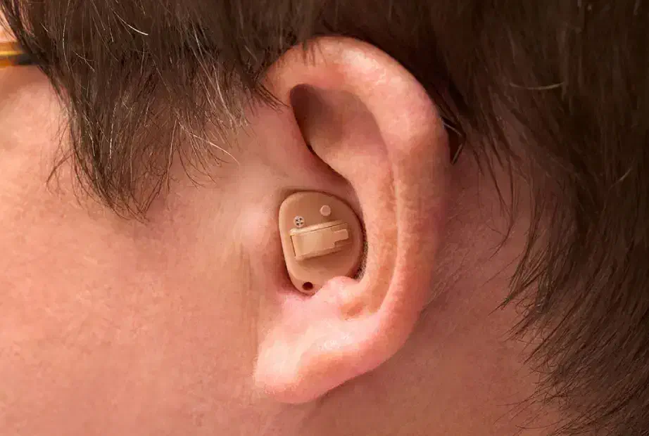 سمعک پسر بچه ای گمشده|اشیا|کرج, شهرک سهرابیه|دیوار