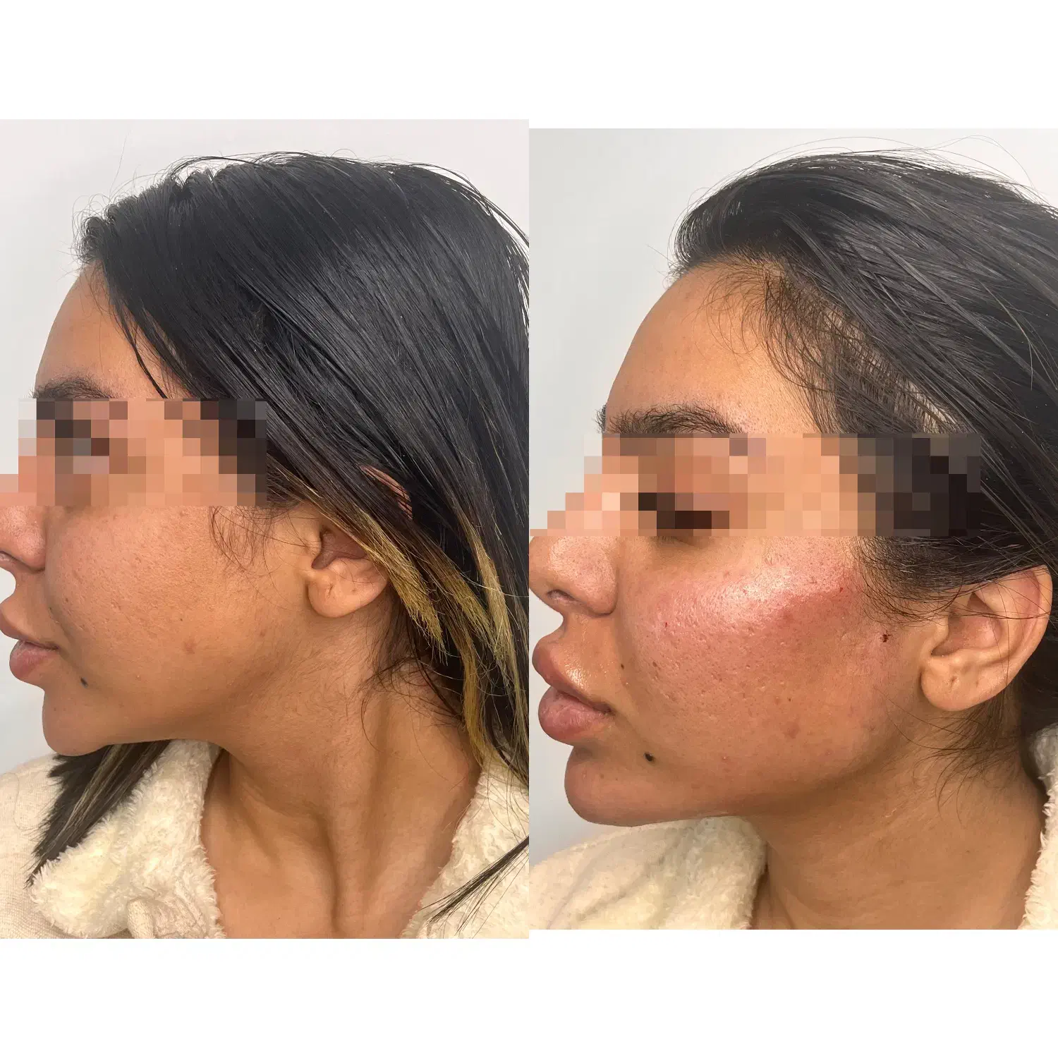 تزریق ژل و بوتاکس و مادلینگ عربی|خدمات آرایشگری و زیبایی|کرمانشاه, |دیوار