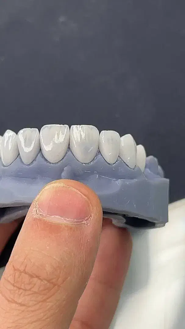 تخفیف ویژه ویژه ویژه روکش|خدمات آرایشگری و زیبایی|تهران, جوادیه|دیوار