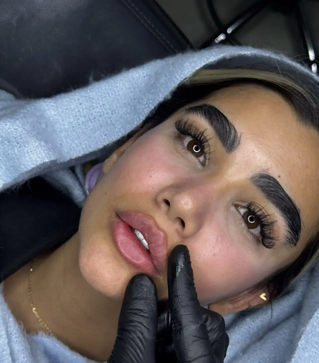 ژل ،بوتاکس، کوچک کردن بینی ،جوانسازی در کیلینیک|خدمات آرایشگری و زیبایی|کرمانشاه, |دیوار