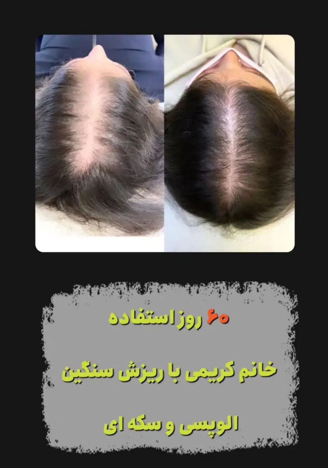 روتین روغن مو عراقی ارگان رزماری بنت السلطان سرشور|آرایشی، بهداشتی، درمانی|مشهد, خواجه ربیع|دیوار