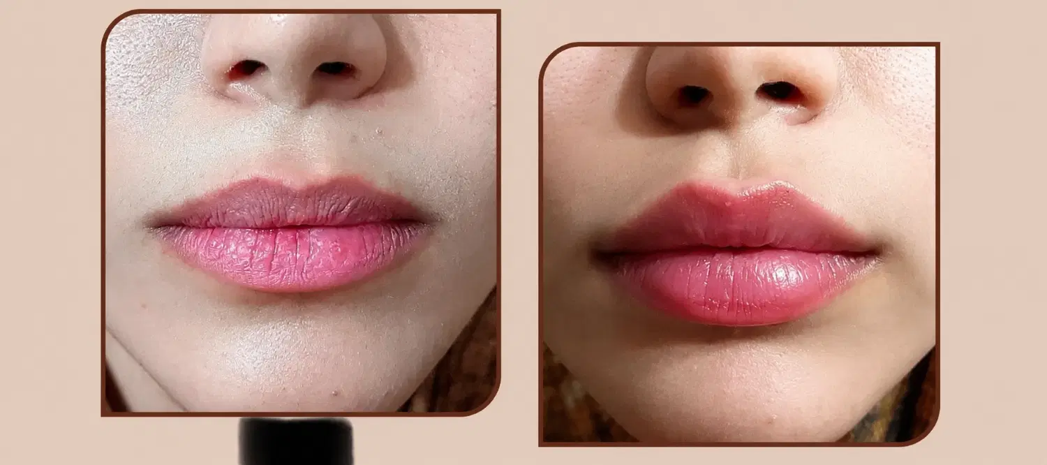 کلینیک زیبایی دکتر امیریان، پزشک و پژوهشگر، خ برق|خدمات زیبایی و سلامت|کرمانشاه, |دیوار