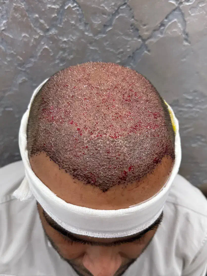 تخفیف ویژه کاشتمو|خدمات آرایشگری و زیبایی|فسا, |دیوار