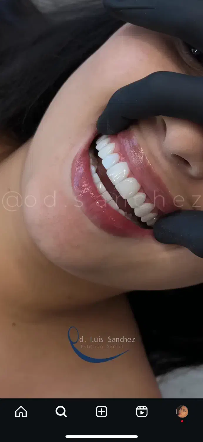 ژل و بوتاکس فرنیا بیوتی|خدمات آرایشگری و زیبایی|شهریار, شهرک وائین|دیوار