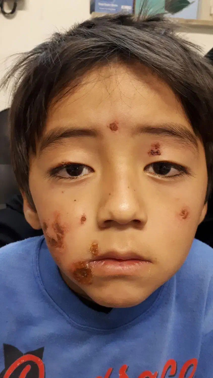 ختنه،جراحی سرپایی شرق|خدمات آرایشگری و زیبایی|دماوند, دماوند|دیوار